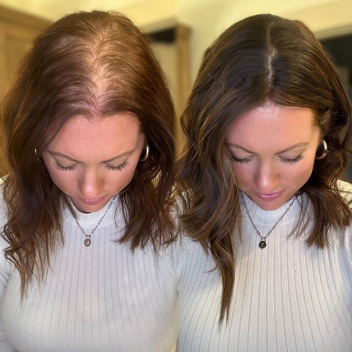 Advanced Hair Growth Roll-on Serum