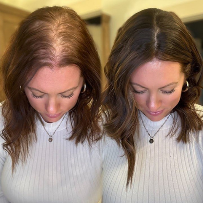 Advanced Hair Growth Roll-on Serum